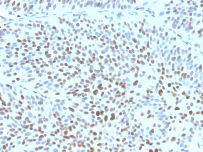 p27/Kip1 Antibody (KIP1/1355R)