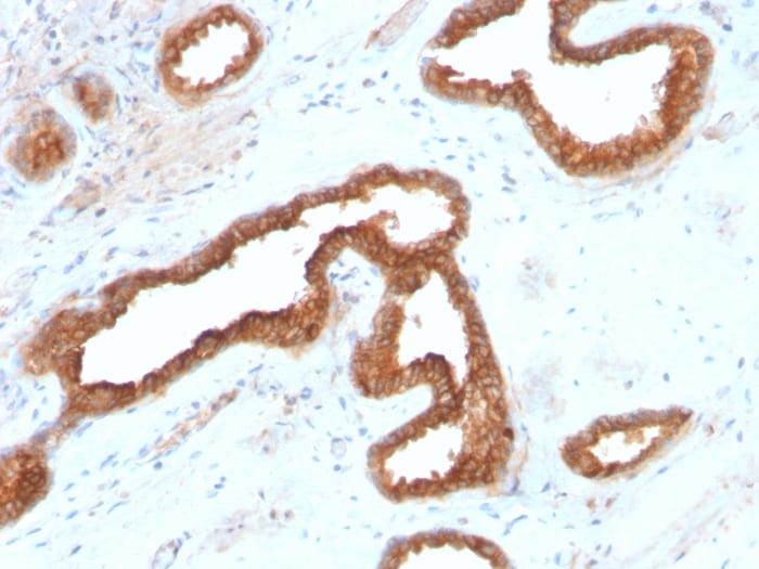 alpha-Methylacyl-CoA Racemase/AMACR Antibody (AMACR/2748R)