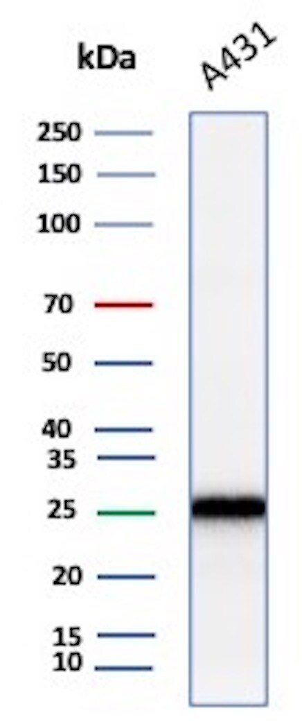 p27/Kip1 Antibody (KIP1/1355R)