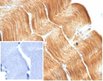 Alpha Actinin 2 Antibody (ACTN2/7040R)