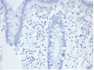 Alkaline Phosphatase/ALPP/ALPI Antibody (rALP/870)