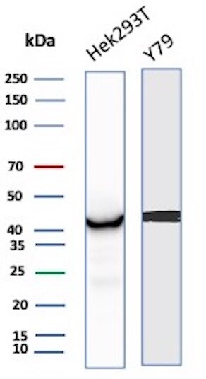 Creatine Kinase BB Antibody (CKBB/8843R)
