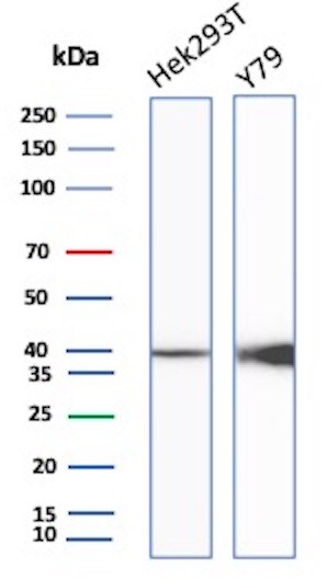 Creatine Kinase BB Antibody (rCKBB/8839)