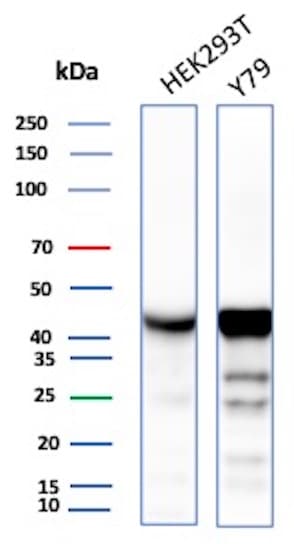 Creatine Kinase BB Antibody (rCKBB/8842)