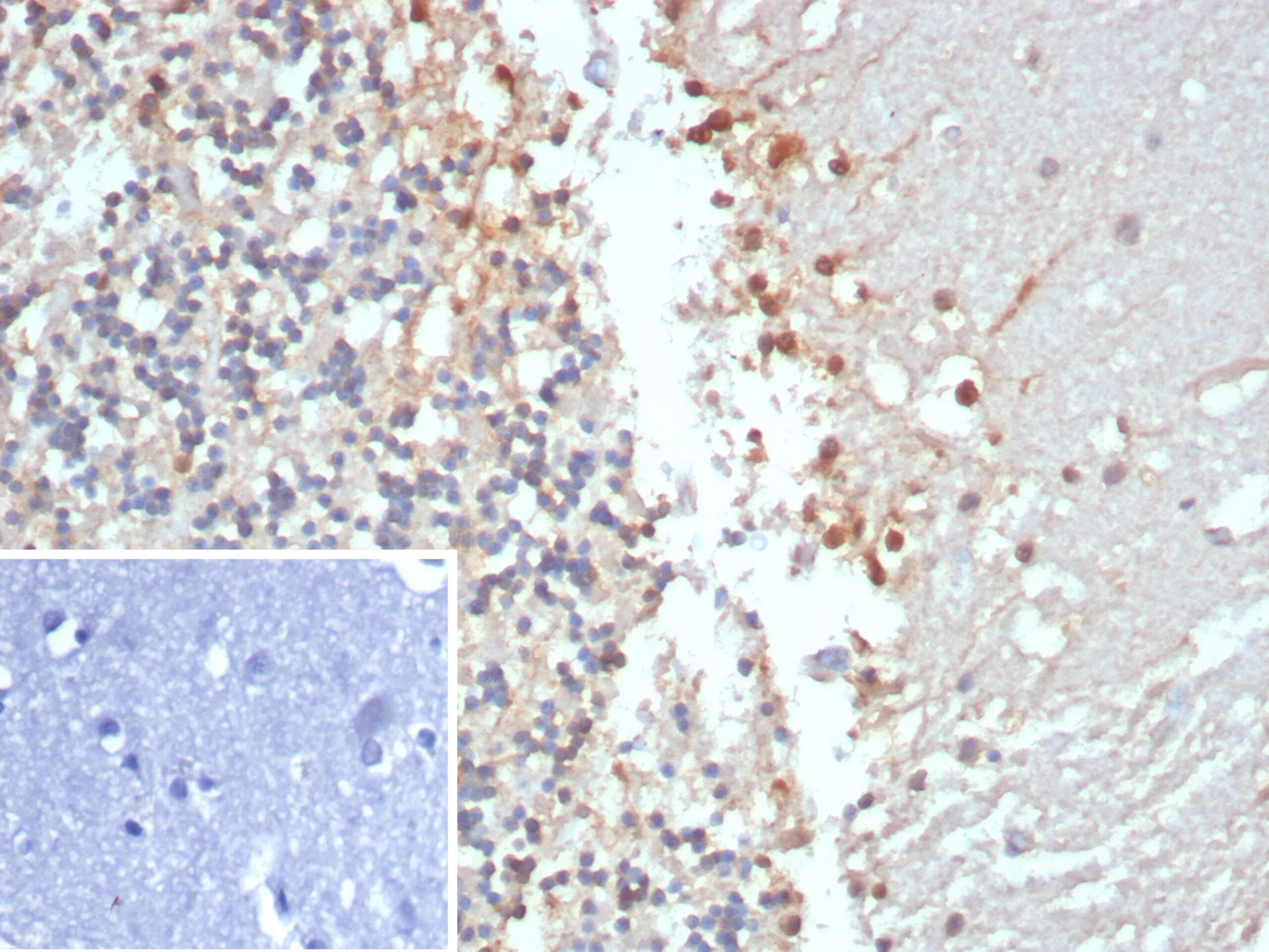 Creatine Kinase BB Antibody (CKBB/8306R)