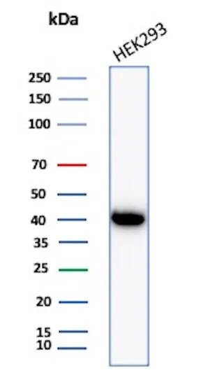 Creatine Kinase BB Antibody (CKBB/8306R)
