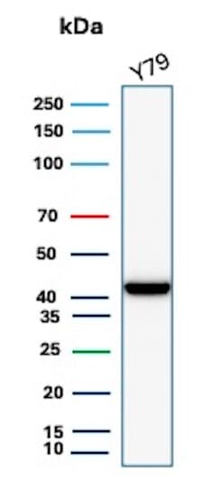 Creatine Kinase BB Antibody (CKBB/8608R)