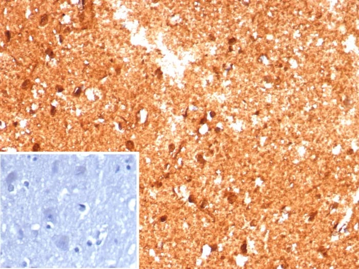 Creatine Kinase BB Antibody (CKBB/8609R)