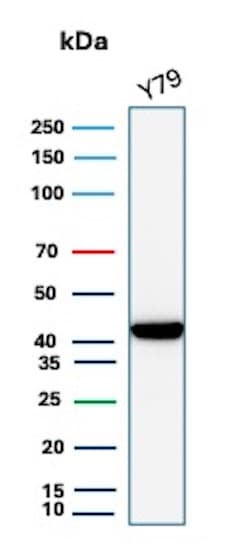 Creatine Kinase BB Antibody (CKBB/8609R)