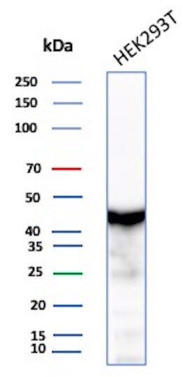 Creatine Kinase BB Antibody (CKBB/8609R)