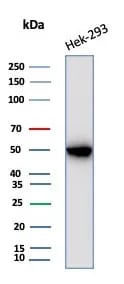 Creatine Kinase BB Antibody (CKBB/8840R)