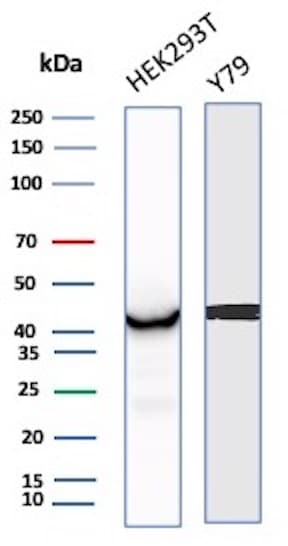 Creatine Kinase BB Antibody (CKBB/8843R)