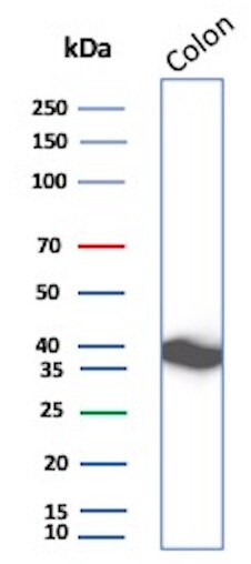 Calponin 1 Antibody (rCNN1/6918)