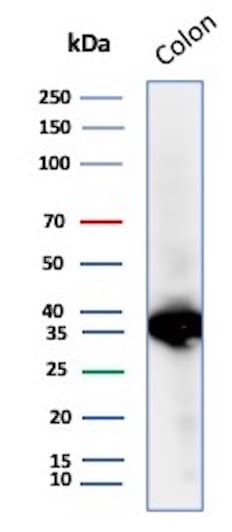 Calponin 1 Antibody (CNN1/8870R)