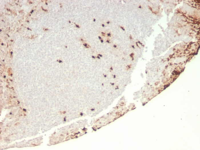 G-CSF Antibody (rCSF3/900)