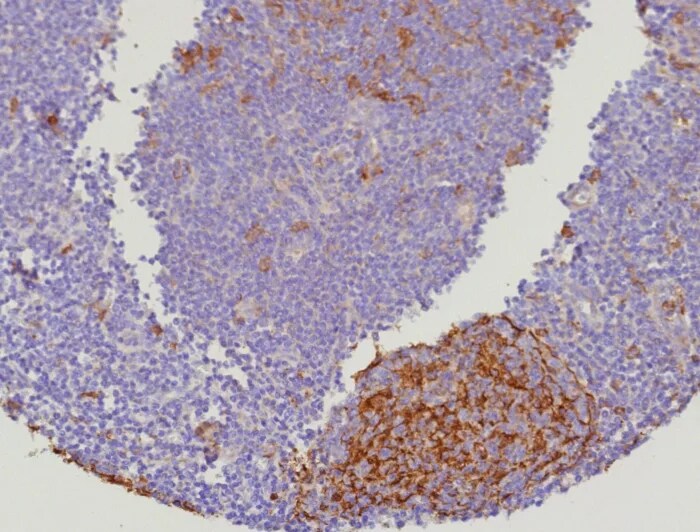Cystatin A Antibody (CSTA/9087R)
