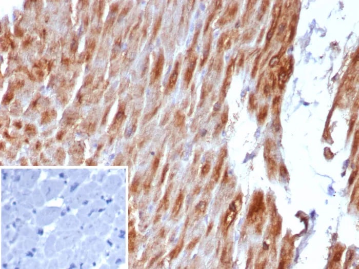 Desmin Antibody (DES/8610R)