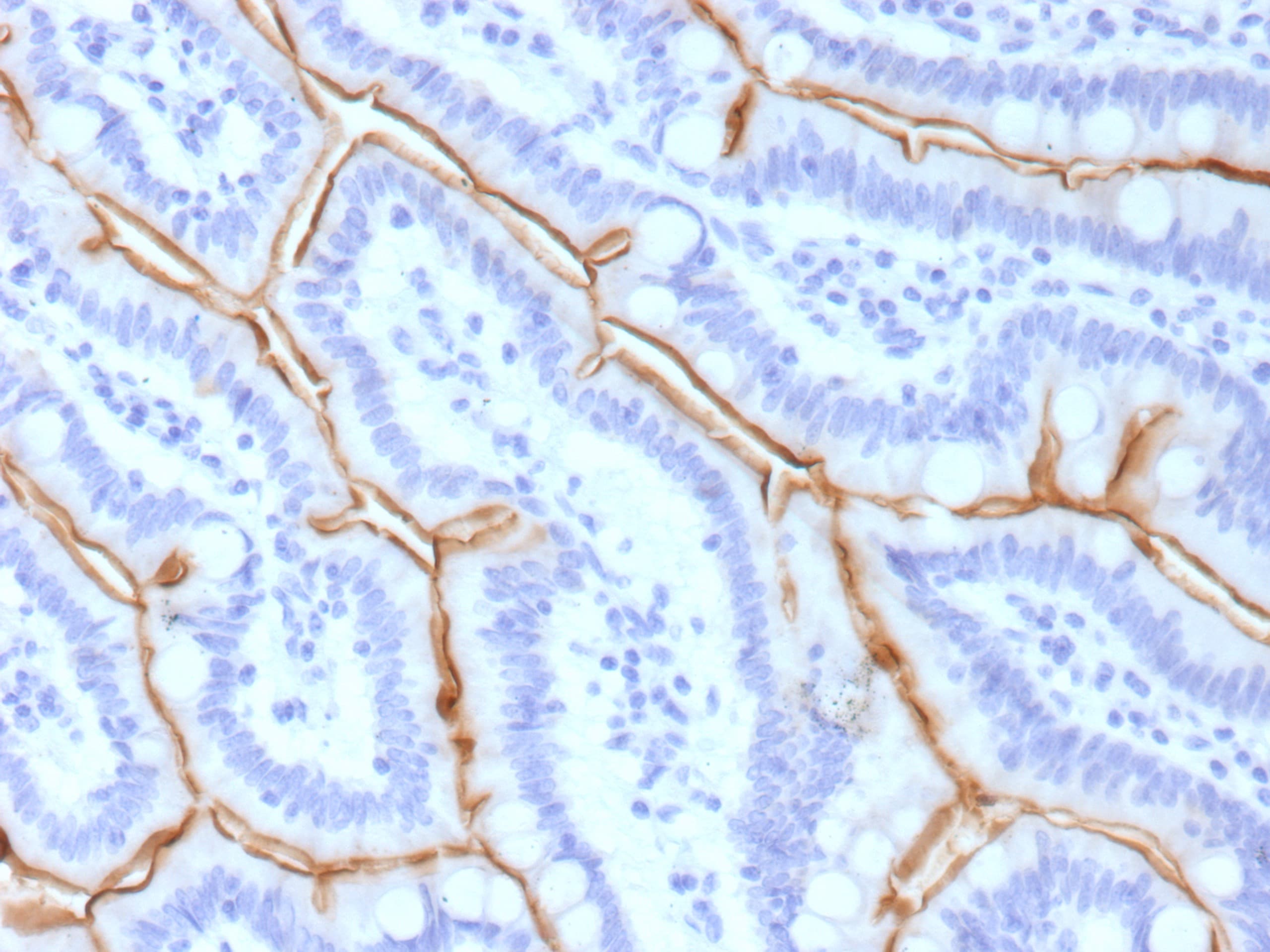 MUC13 Antibody (MUC13/13111)