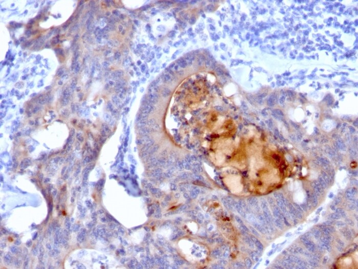 ECM-1/Secretory Component P85 Antibody (rECM1/792)