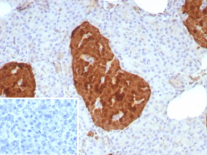 Enolase 2/Neuron-specific Enolase Antibody (rENO/8857)