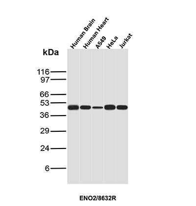 Enolase 2/Neuron-specific Enolase Antibody (ENO/8632R)