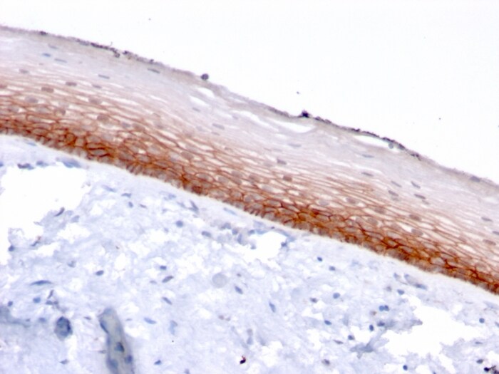 CD44, variant 4/5 Antibody (3D2)