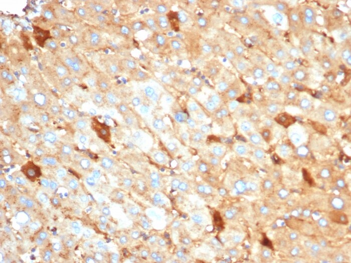 Albumin Antibody (rALB/6410)