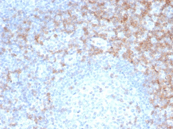 CD5 Antibody (rC5/6462)