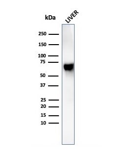 Albumin Antibody (rALB/6410)