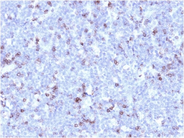 CD43/Sialophorin Antibody (rSPN/1094)