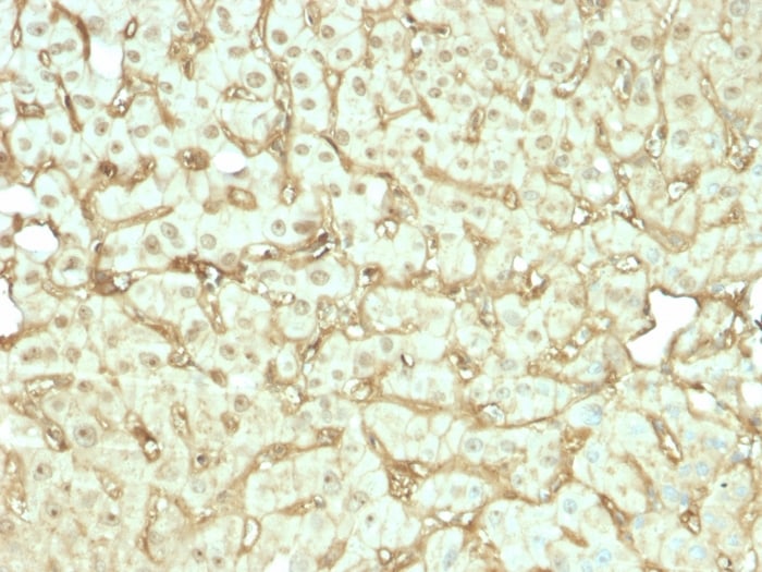 Albumin Antibody (rALB/6412)