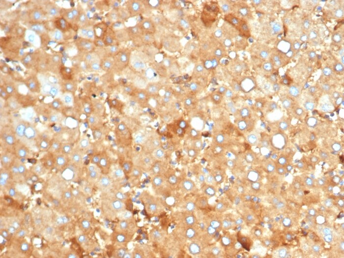 Albumin Antibody (rALB/6412)