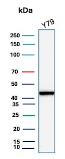 Creatine Kinase BB Antibody (CKBB/8306R)