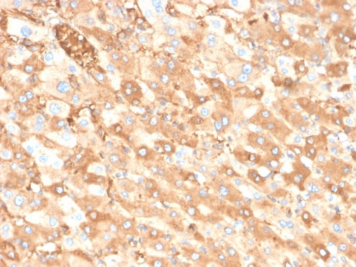 Albumin Antibody (ALB/6413R)