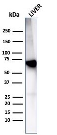 Albumin Antibody (rALB/6414)