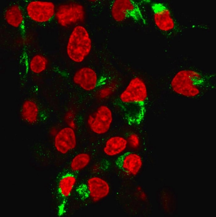Albumin Antibody (ALB/6413R)