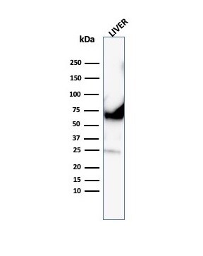 Albumin Antibody (ALB/6413R)
