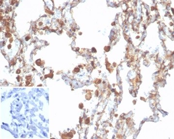 Aldehyde Dehydrogenase 1-A1/ALDH1A1 Antibody (rALDH1A1/7285)