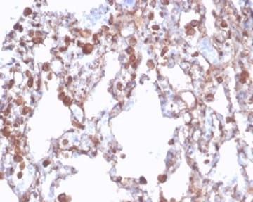 Aldehyde Dehydrogenase 1-A1/ALDH1A1 Antibody (rALDH1A1/7285)