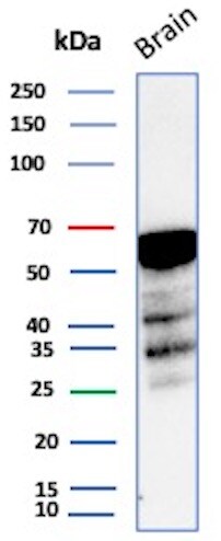 Aldehyde Dehydrogenase 1-A1/ALDH1A1 Antibody (rALDH1A1/7285)
