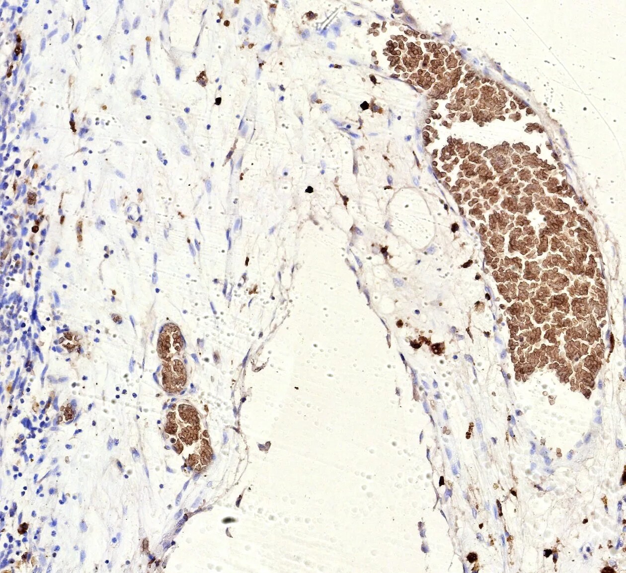 FLI1 Antibody (rFLI1/9614)