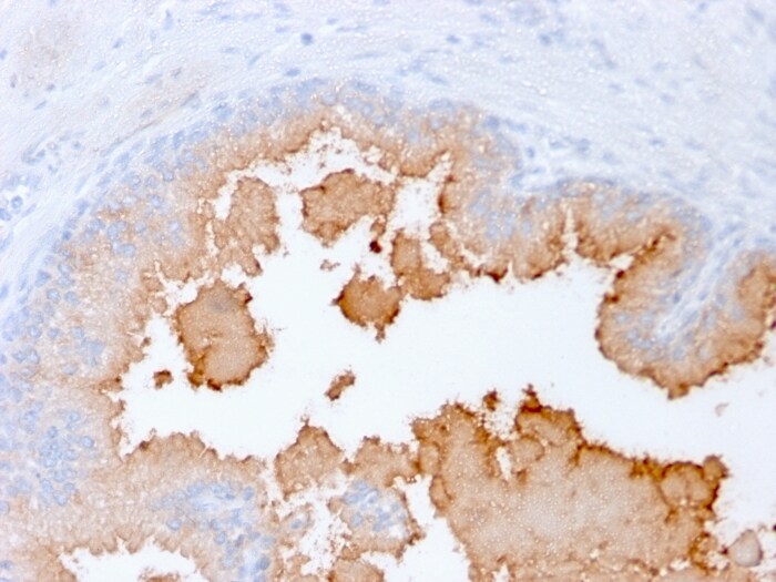 alpha-Methylacyl-CoA Racemase/AMACR Antibody (rAMACR/1864)