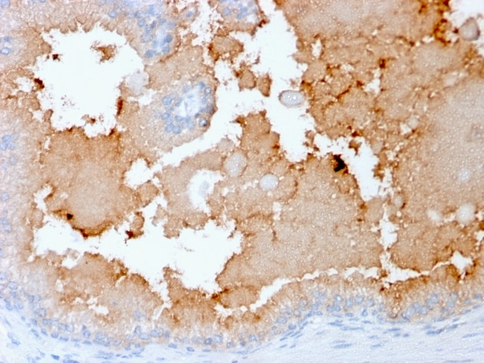 alpha-Methylacyl-CoA Racemase/AMACR Antibody (rAMACR/1864)