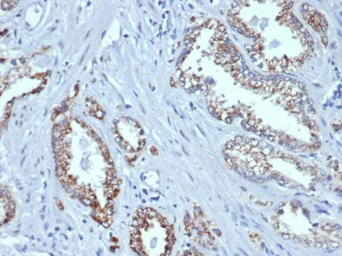 alpha-Methylacyl-CoA Racemase/AMACR Antibody (rAMACR/6369)