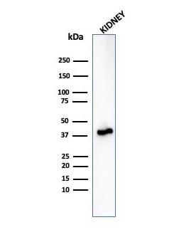 alpha-Methylacyl-CoA Racemase/AMACR Antibody (rAMACR/6369)