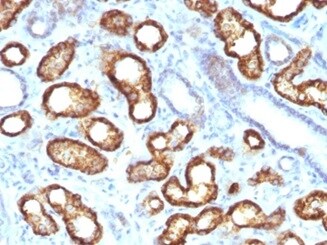alpha-Methylacyl-CoA Racemase/AMACR Antibody (AMACR/3931R)
