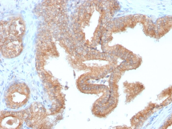 alpha-Methylacyl-CoA Racemase/AMACR Antibody (AMACR/2748R)
