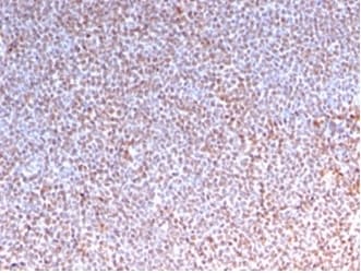 ALK/CD246 Antibody (rALK1/1504)