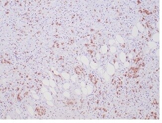 ALK/CD246 Antibody (ALK1/7008R)