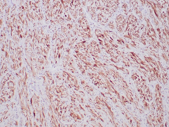 ALK/CD246 Antibody (ALK1/6698R)